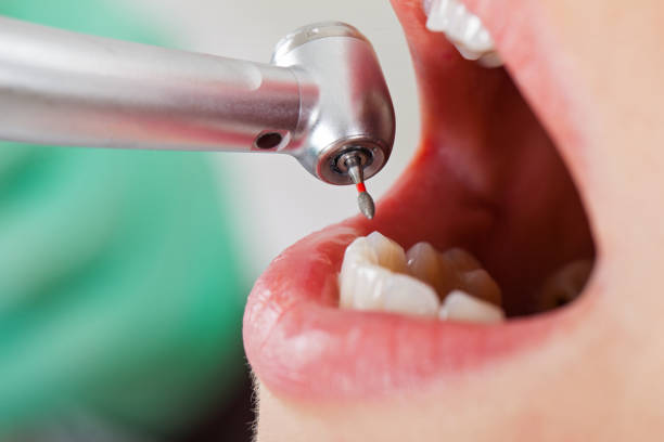Professional Emergency Dentist in IA